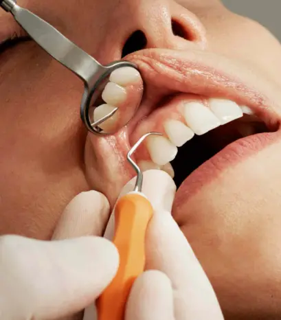 Dental Hygiene | Castlebury Dental