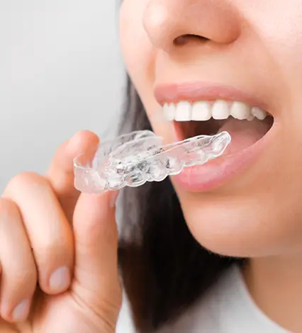 Invisalign Frequently Asked Questions