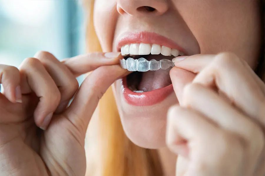 Why you should wear a retainer per your dentist's recommendation