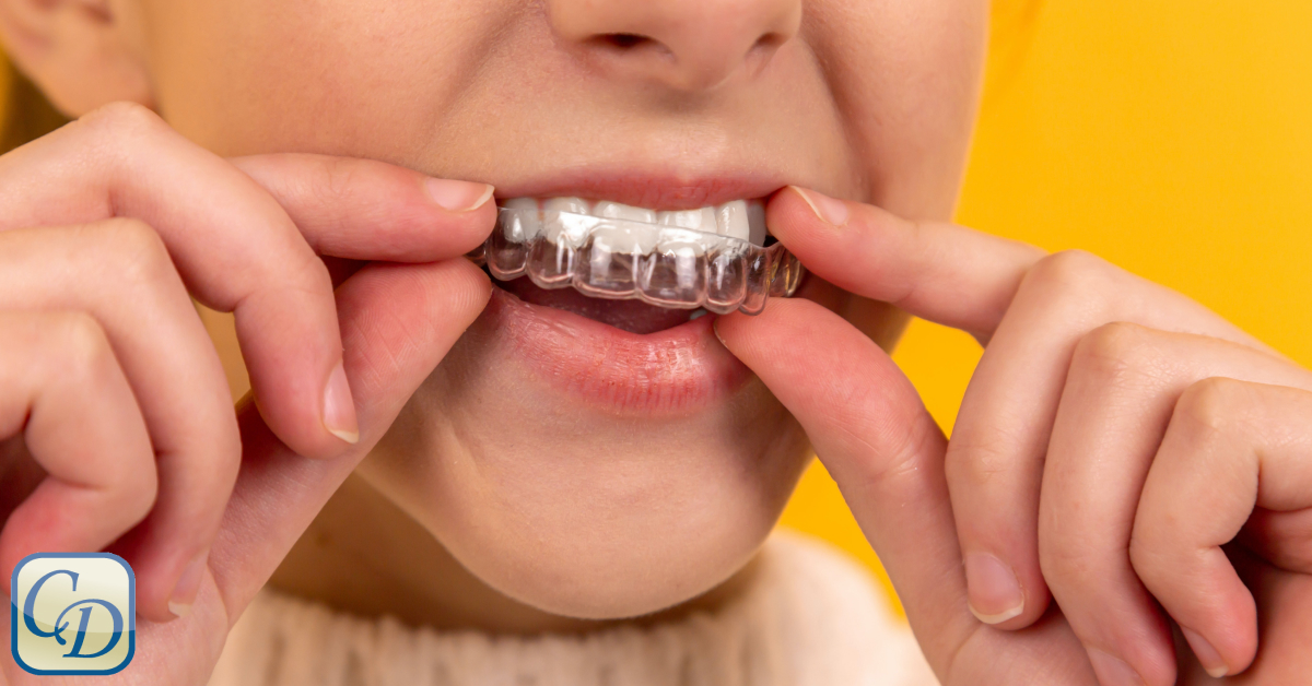 How to Get Insurance Coverage for Your Invisalign Treatment