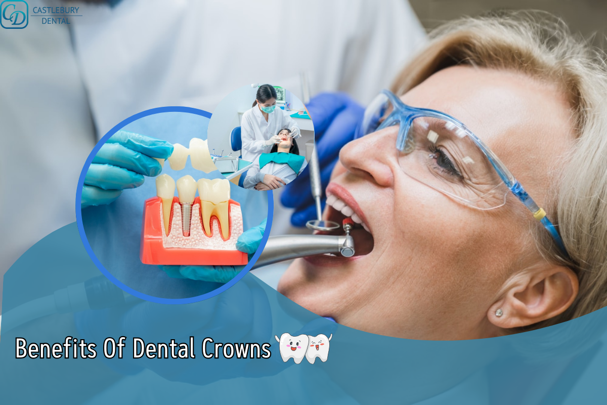 Dental crowns