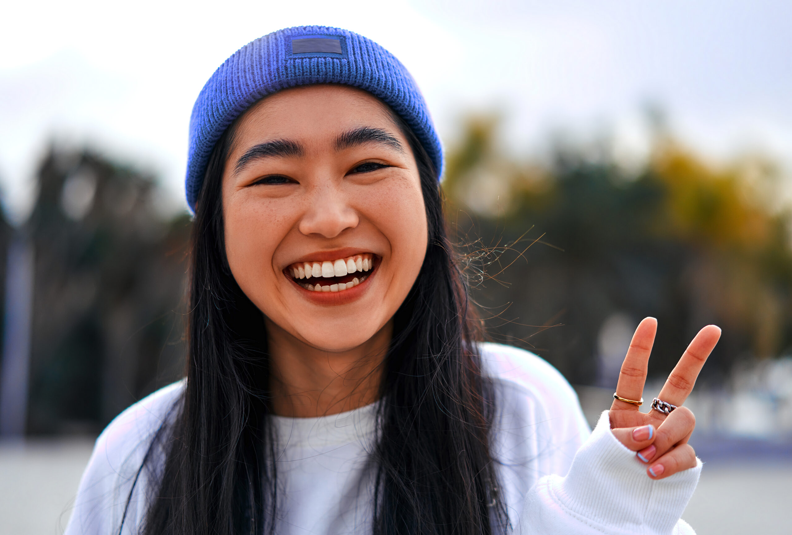 teeth whitening eagle