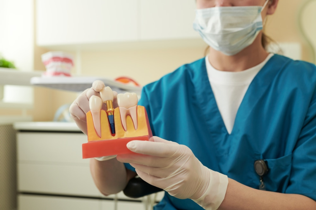 dental implants eagle