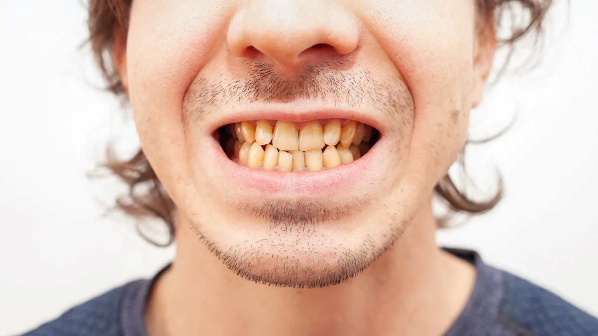 gentleman with yellow teeth